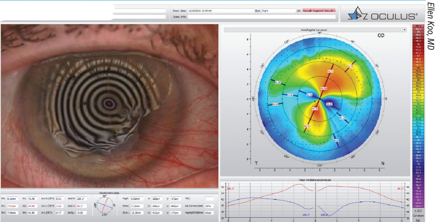 https://www-reviewofophthalmology-com