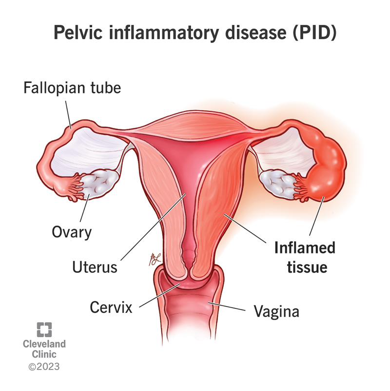 https://my.clevelandclinic.org/