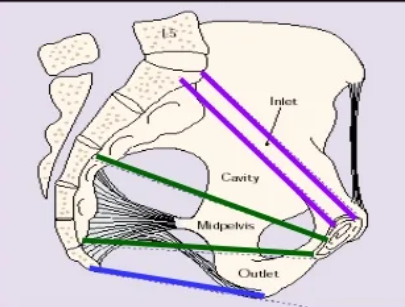 Pelvic planes (bidang Hodge). Sumber: https://en.sperohope.com/planos-de-hodge-identificaci-n