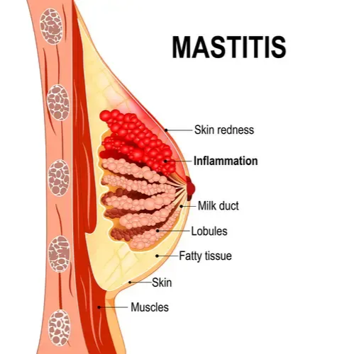 (https://www.webmd.com/)