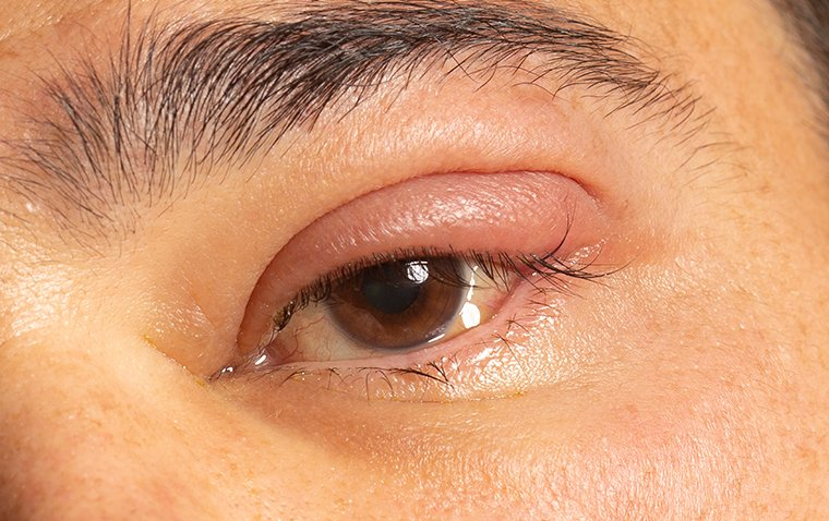 https://ophthalmologybreakingnews.com/