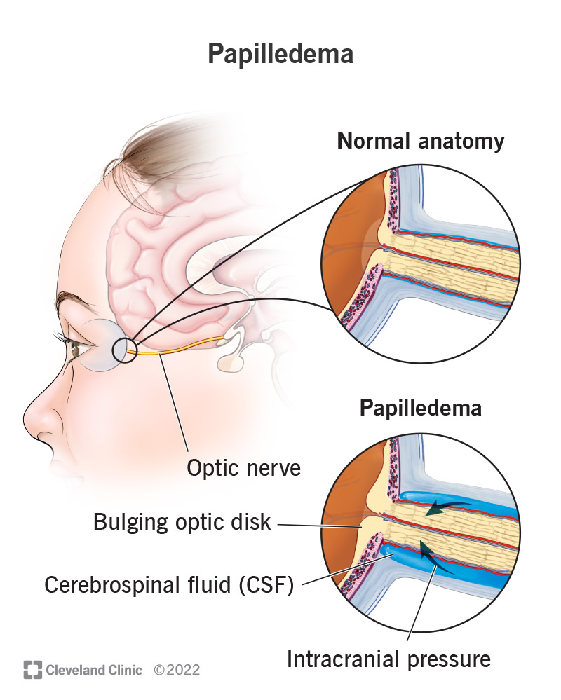 https://my.clevelandclinic.org/