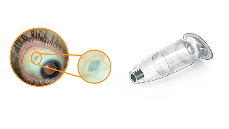 (https://www.medscape.com/viewarticle/939042?form=fpf)