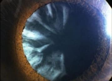 https://atlaseye.sg/
