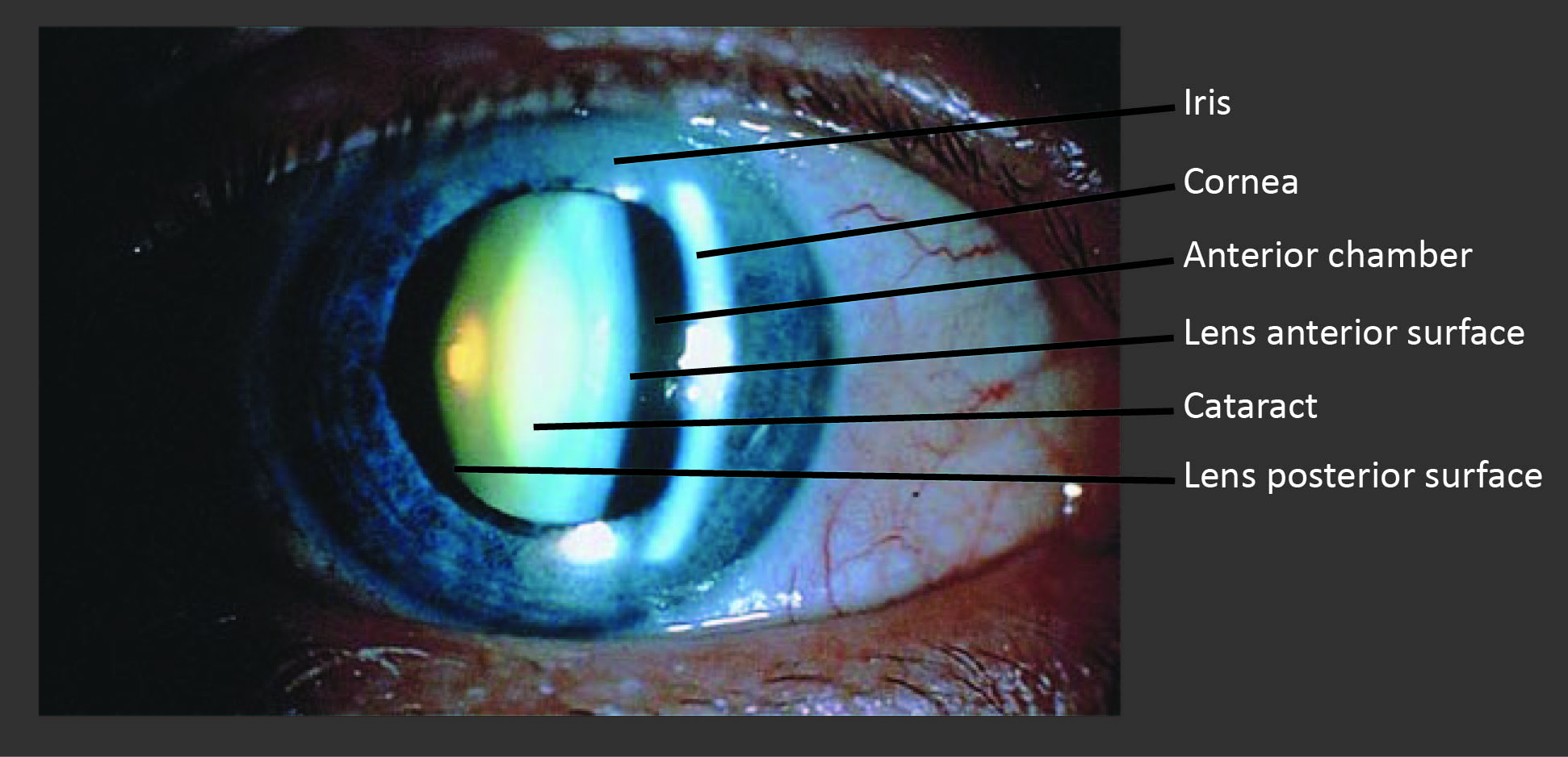 https://cataractcourse.com/