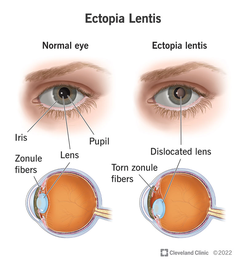 https://my.clevelandclinic.org/