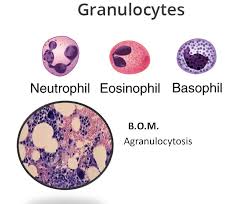 Gambar ini mengilustrasikan bahwa pada agranulositosis, terdapat kekosongan granulosit—terutama neutrofil—baik dalam sirkulasi darah maupun produksi dari sumsum tulang.https://www.gastroepato.it/