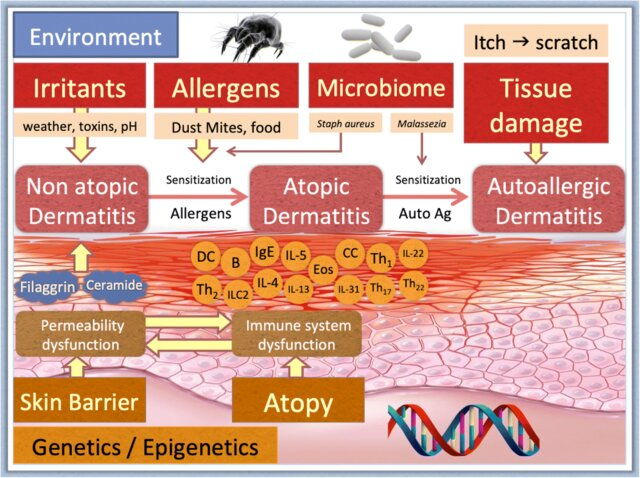 Patofisiologi dermatitis atopik (Sánchez-Borges dkk, 2019)