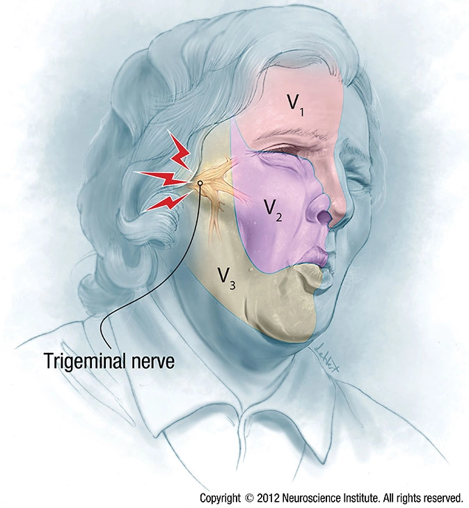 (https://seattleneurosciences.com)