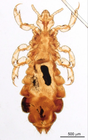 Gambaran Pediculus humanus capitis (Nicolad dkk, 2010)