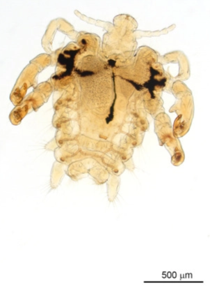 Gambaran Pthirus pubis (Nicolad dkk, 2010)