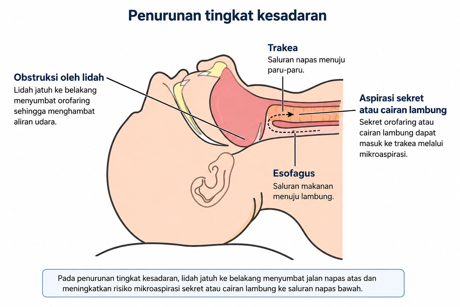(https://www.pedilung.com/ dan dimodifikasi dengan AI )