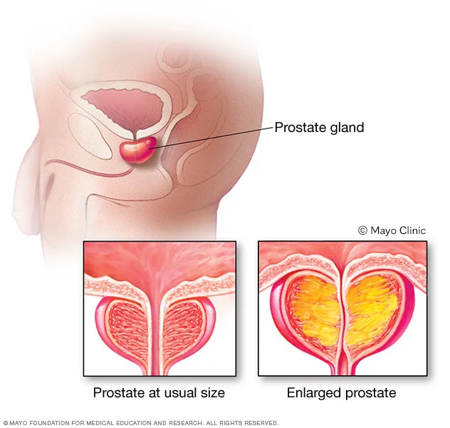 (https://www.mayoclinic.org/)