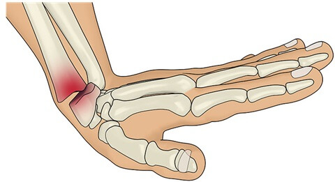 (https://www.shoulder-pain-explained.com/)