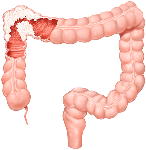 (https://www.cookmedical.com/)