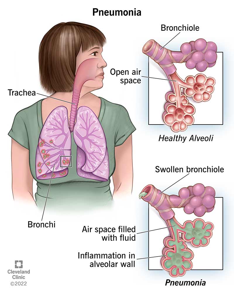 (https://my.clevelandclinic.org/)