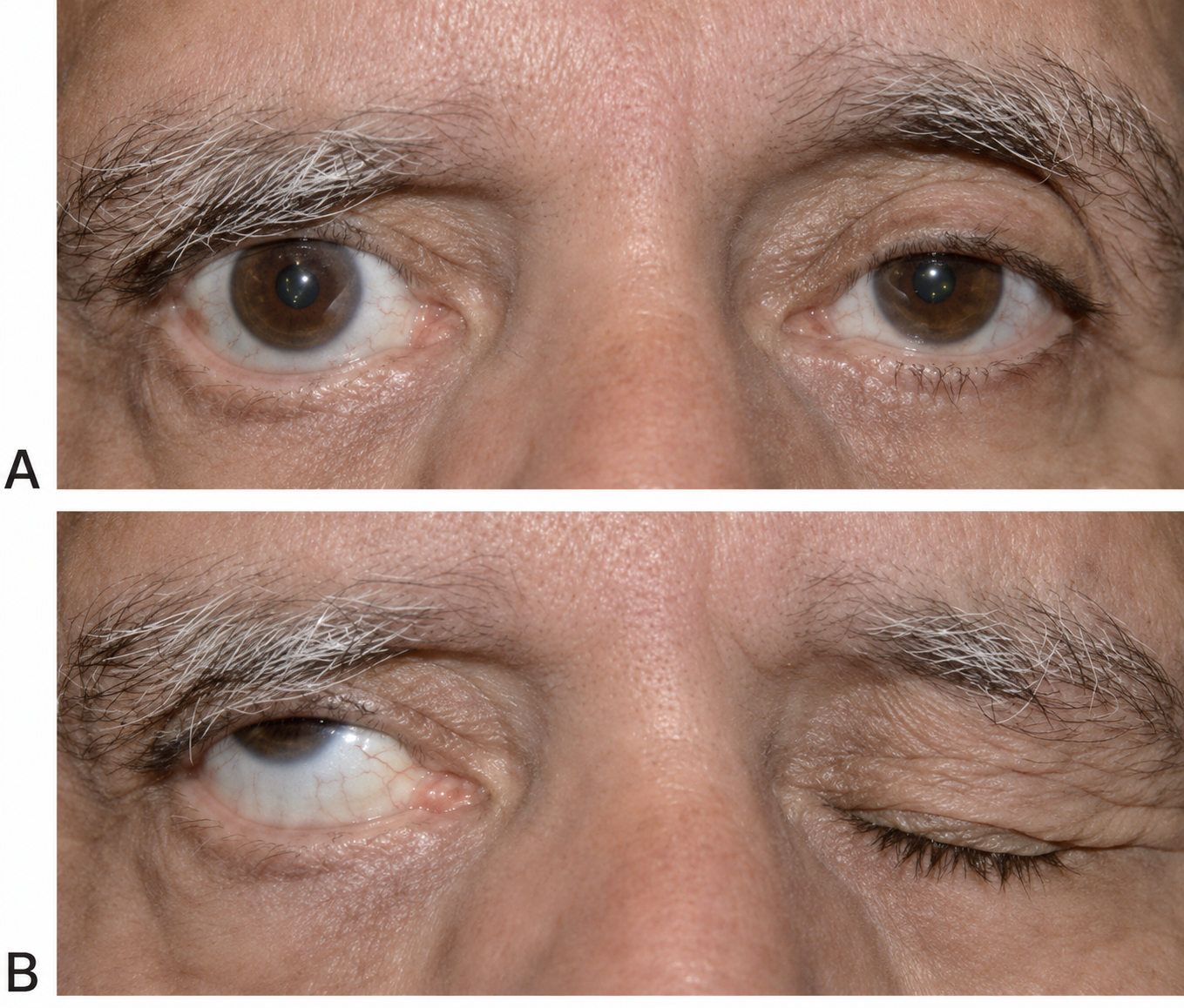 (https://eyewiki.org/)