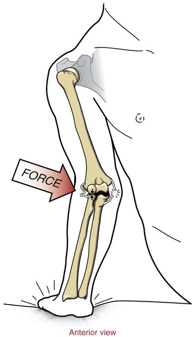 (https://musculoskeletalkey.com/)