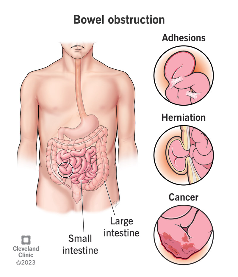 (https://my.clevelandclinic.org/)