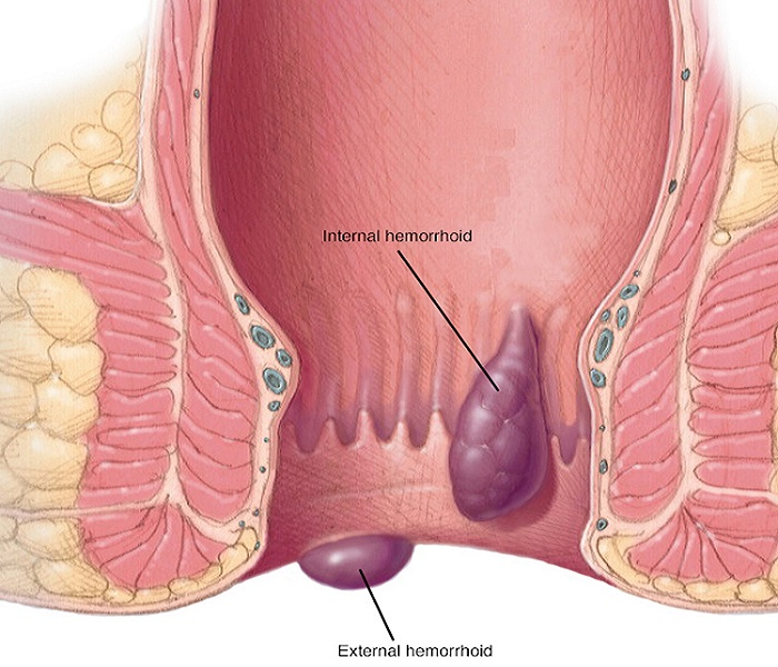 (https://indorelaparoscopycenter.com/)