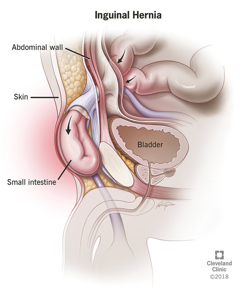(https://my.clevelandclinic.org/)